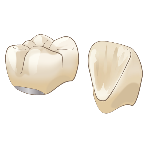 【エステニア】自然歯のように白く美しい歯